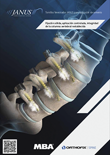 TORNILLOS FENESTRADOS JANUS