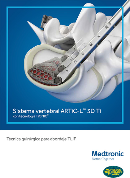 ARTIC-L<sup>™</sup> 3D Ti